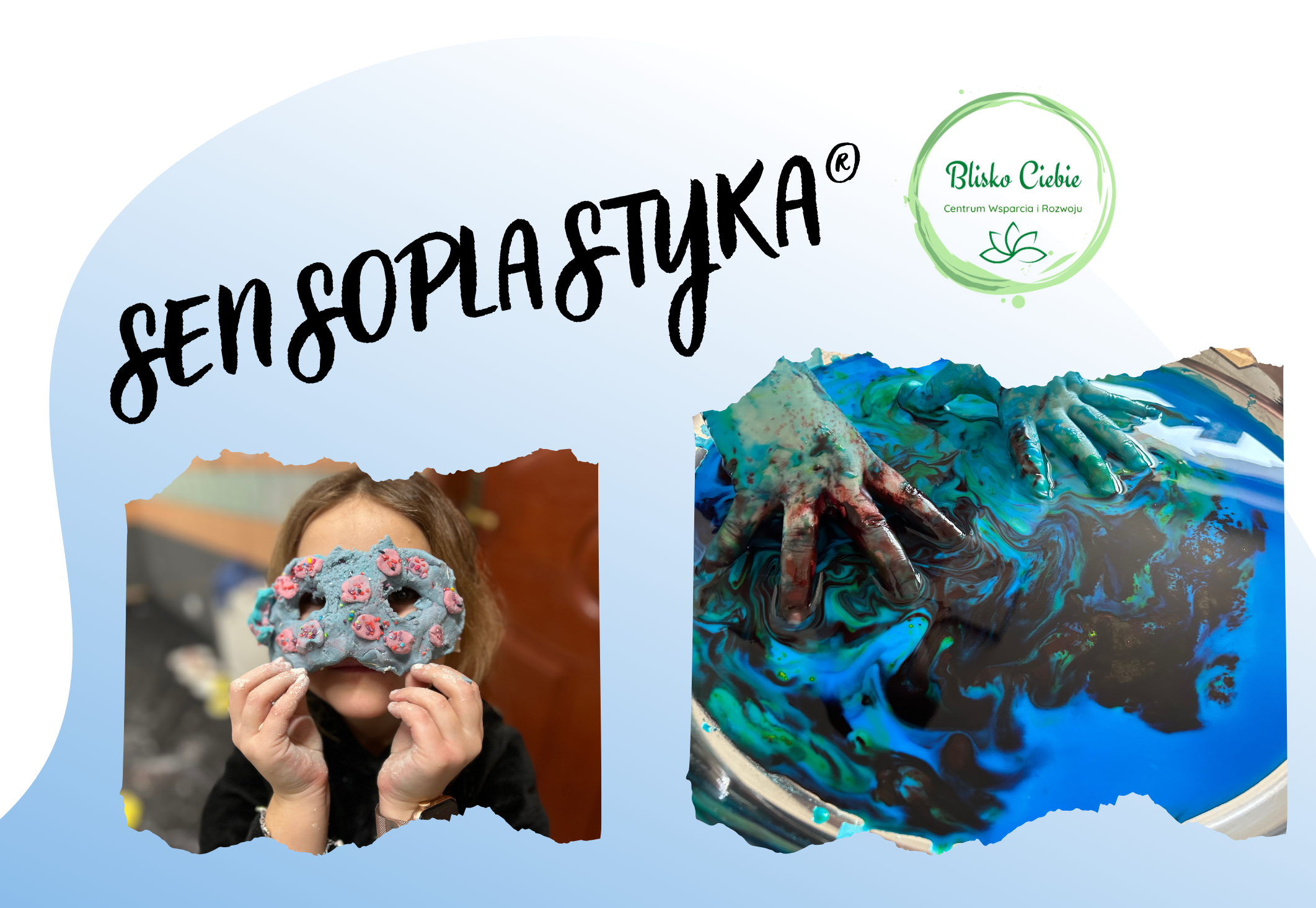 sensoplastyka